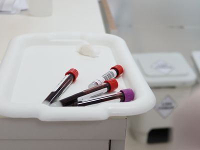 vials of blood for blood testing